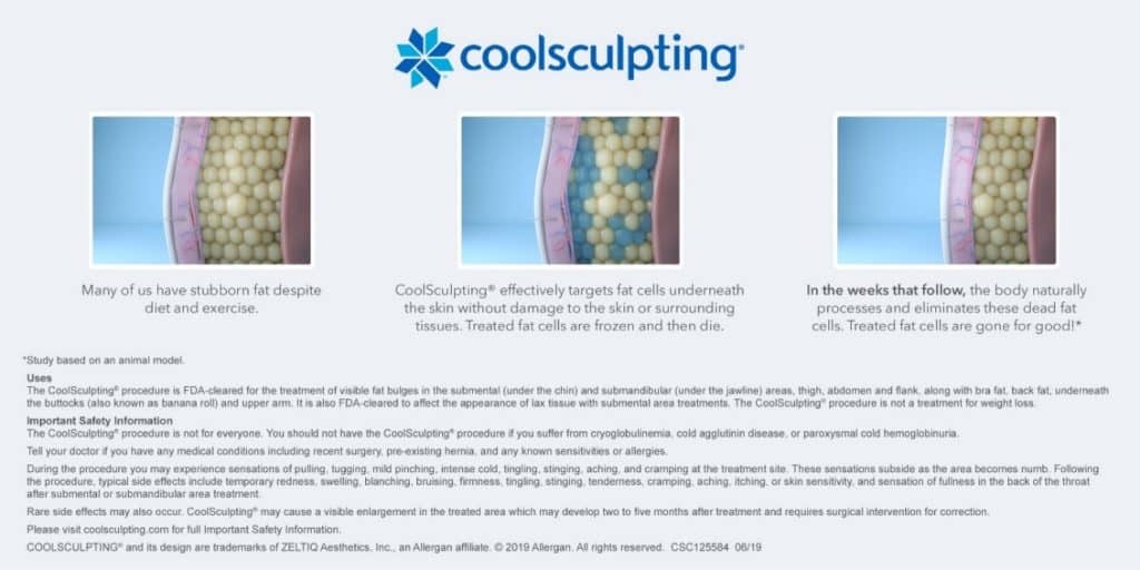 Imagery showing How CoolSculpting works