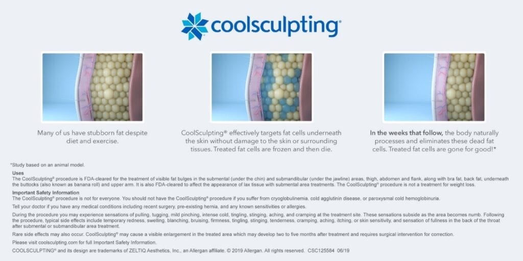 Descriptive image depicting the process of CoolSculpting treatment.