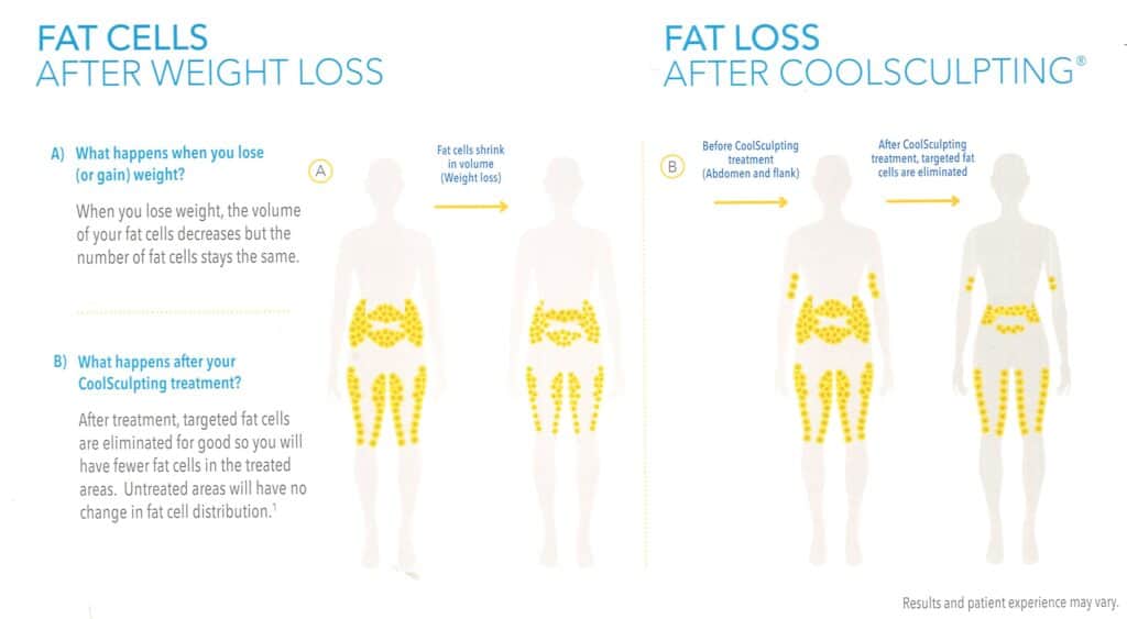 fat cells before and after coolsculpting