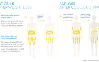 Fat Loss vs. Weight Loss