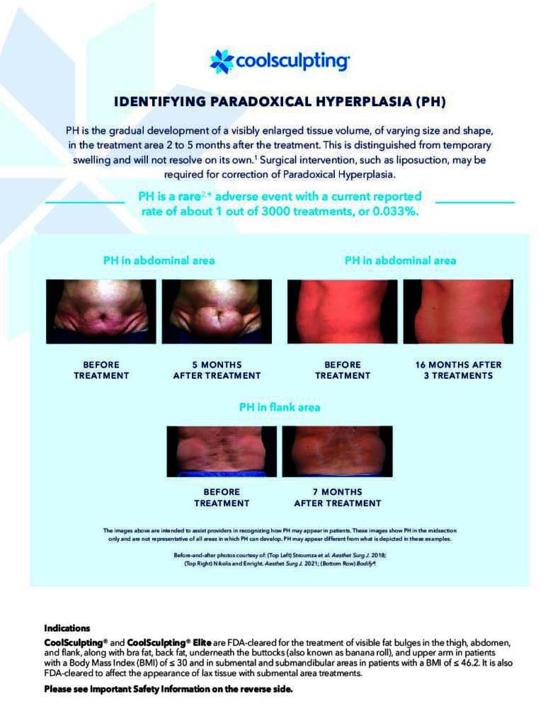 Identifying PH coolsculpting side effect educational slide