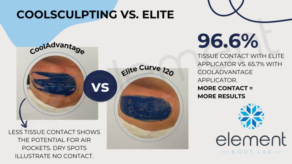 coolsculpting vs coolsculpting elite paint study