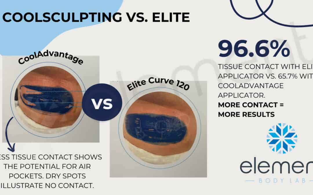 CoolSculpting Elite in Dallas, TX: Is Elite Better? Element Body Lab