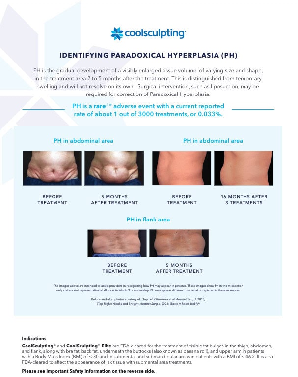 identifying PAH - what does paradoxical adipose hyperplasia look like