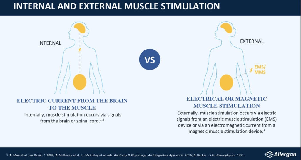 Internal vs external muscle stimulation diagram explaining how magnetic muscle stimulation or EMS work