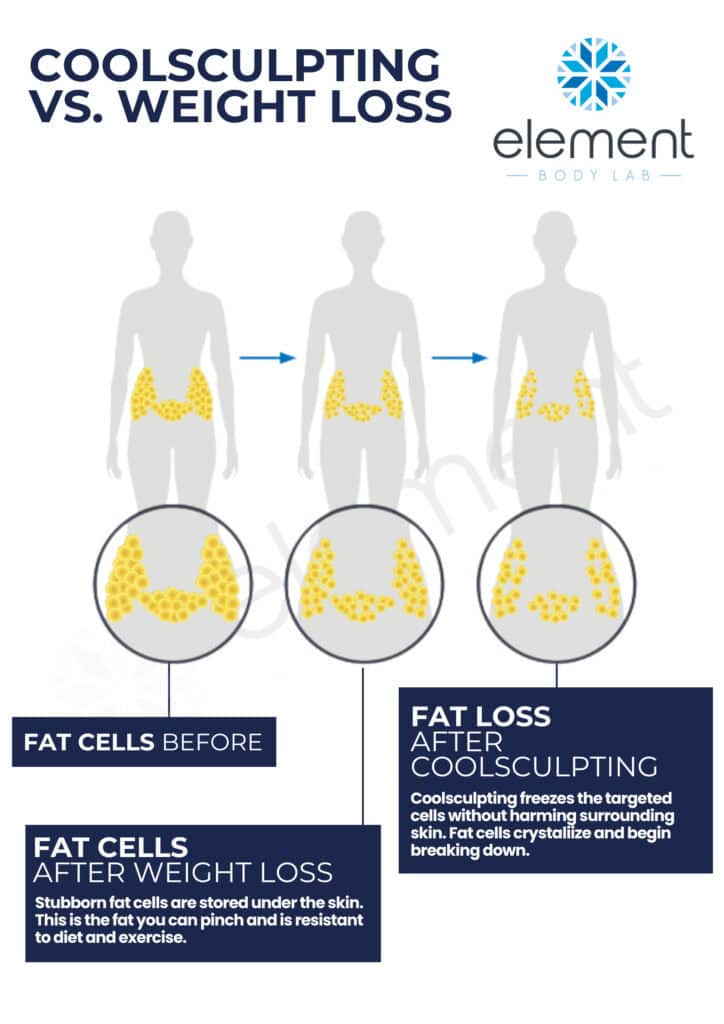 coolsculpting vs weight loss