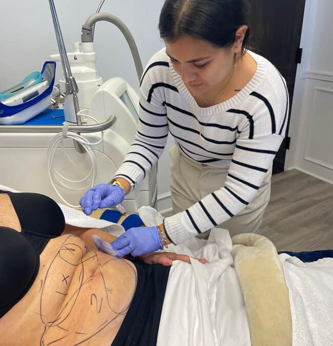 How To Self-Massage After CoolSculpting